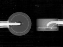 between certain Scanditronix NACP chambers. Figure 2 shows side-on radiographs of a Scanditronix and a Dosetek NACP chamber.