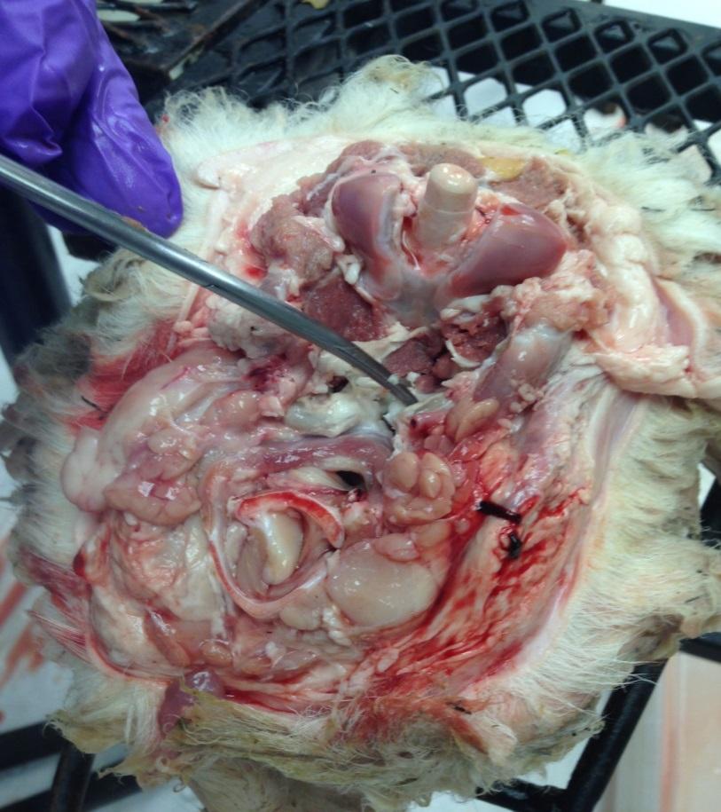 This will tear the tissue which covers the node and expose the Retro lymph node.