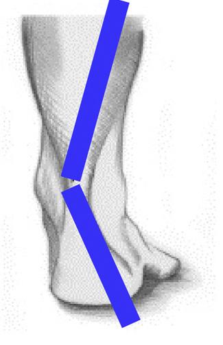 If you notice more wear on the inner aspect or that the wear is spread evenly across the whole of the heel then this means you are landing on your heels with too much inward tilt (pronation box 1).