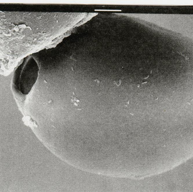 . n empty egg showing the operculum (O) 40x. lacked fin folds (Figure 12). lateral groove extended the length of the tail.