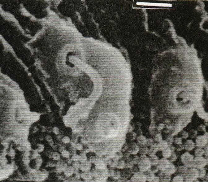 These spherical bodies have been observed in several other species of trematodes but the exact function is unknown (Fujino and Ichikawa, 2000). lthough McLaughlin et al.