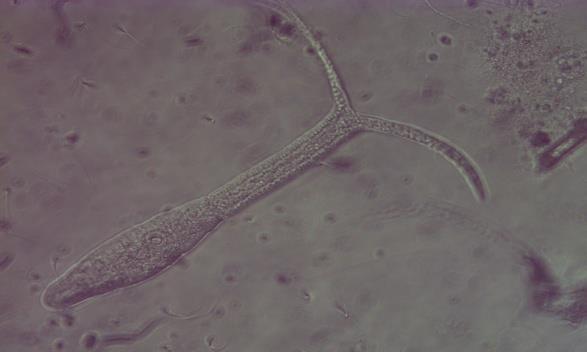 a) Human infective cercariae
