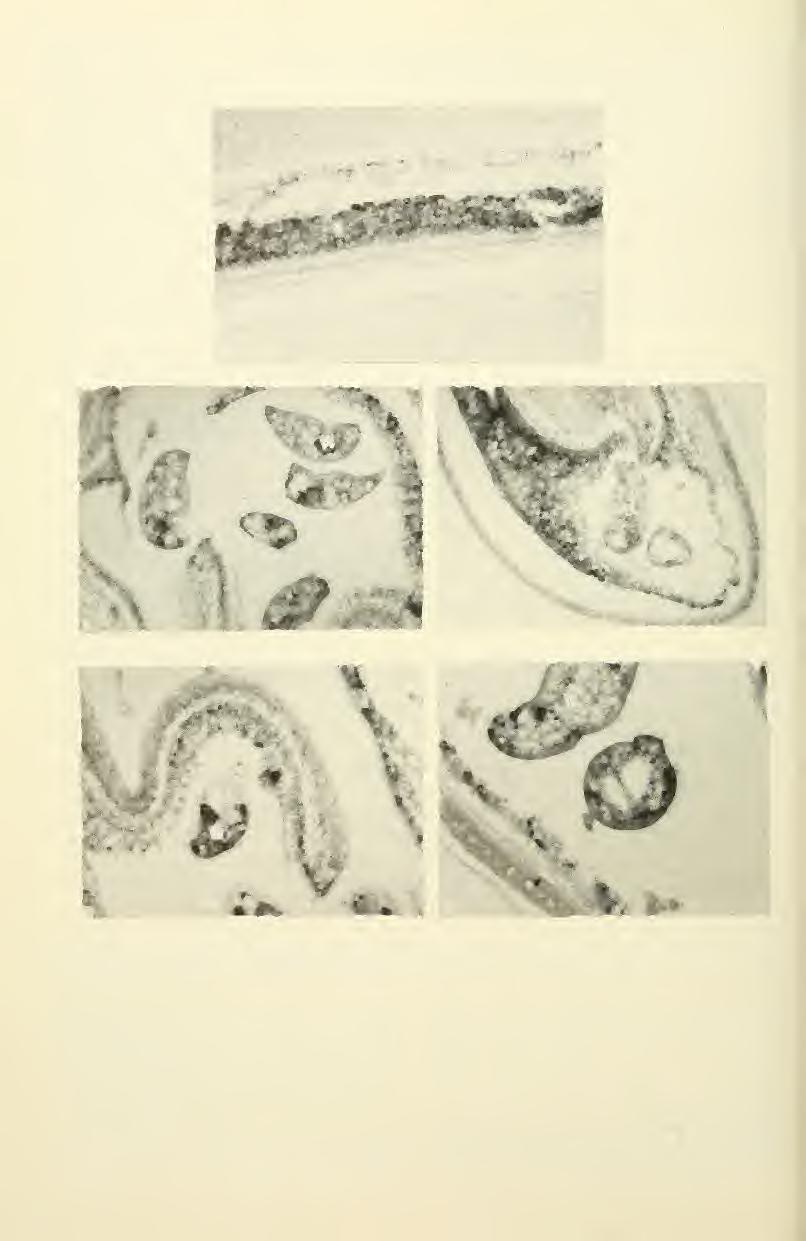 678 Great Basin Naturalist Vol. 43, No. 4 Fig. 1. Figure A represents normal tissue found in the vitreous-retina area of a fish eye.