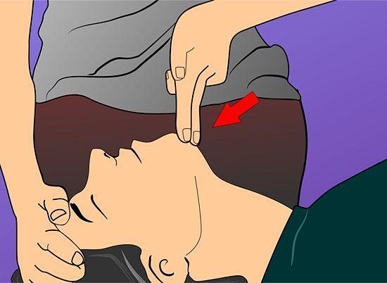 Place your hand on the victim's forehead and two fingers on their chin and tilt the head back to open the airway.