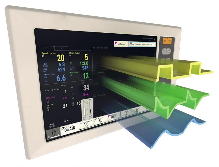WAEFORMS AND LOOPS Waveforms Waveforms allow for a quick assessment of how ventilation parameters interact and how patient dependant