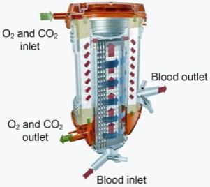 Porumamilla Abstract The paper presents three different types of LQG based controllers designed for tracking control of the arterial partial pressures of the blood gases; oxygen and carbon dioxide (O