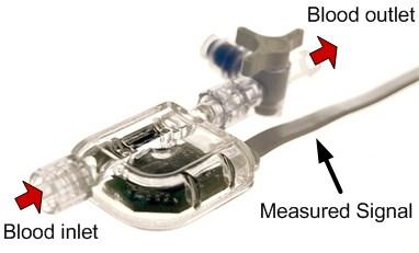 In this procedure, the blood is circulated out of the body and into an ECMO machine where the O 2 and CO 2 gas levels are restored before being pumped back into the body.
