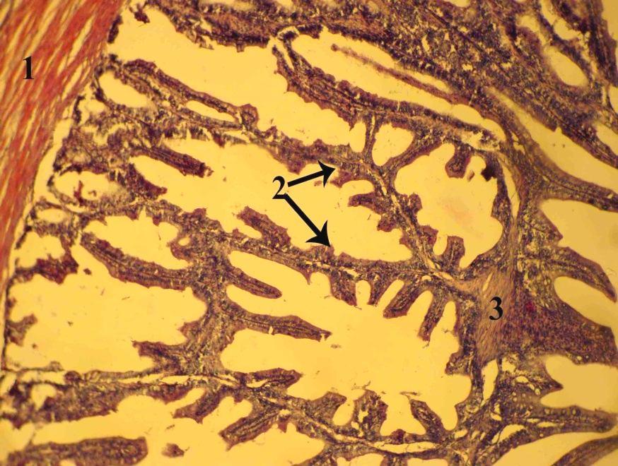 Fig. 5: (1): Trabecula, (2): Villus, (3): Smooth muscle (H and E, 400). The primary villi were leaf-like and slender.