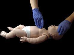 If no pulse is present, or if the infant s heart rate is <60 beats/min with signs of poor perfusion, begin CPR with cycles of 30 compressions: 2 breaths using 2 fingers about