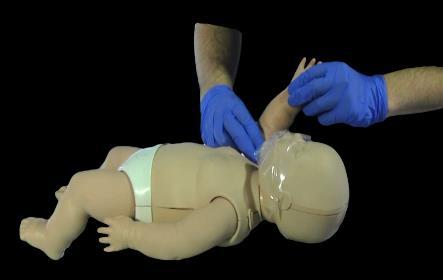 When Rescuer 2 arrives, the CPR cycle should switch to 15 compressions to 2 ventilations with the BVM if it is available.
