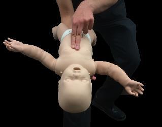 over. 20 CHILD CHOKING CONSCIOUS Approach child and ask,