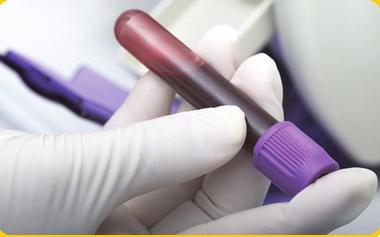Running Samples Before running a patient sample, take a few seconds to visually inspect the sample for clots. Hold the test tube at eye level and slowly invert the tube.