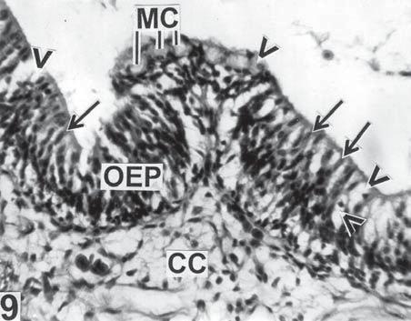 Basal part of sensory epithelium showing ciliated receptor cells (broken arrow), rod cells (arrow heads), and microvillus cells (solid arrows); SEM 5000. Figure 10.