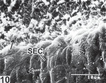 mucous cells (broken arrows) in between SEC; SEM 5000.