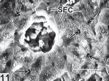 Under SEM study, the non-sensory epithelial surface is provided with compactly arranged, stratified epithelial cells (8 to 9 mm in height), leaving mucous cells in between.