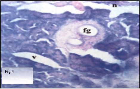 Noga and Dykstra (1986) [21] were of the opinion that marked granuloma and inflammatory response were shown by fish infected with Aphanomyces sp. Hatai et al.