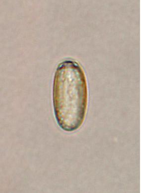 Description based on 12 adult flukes is as follows (Fig. 3): Body bilobed, resembling the rice scoop, 572.5 (530-560) μm long and 372.5 (330-400) μm in maximum width at testicular level.