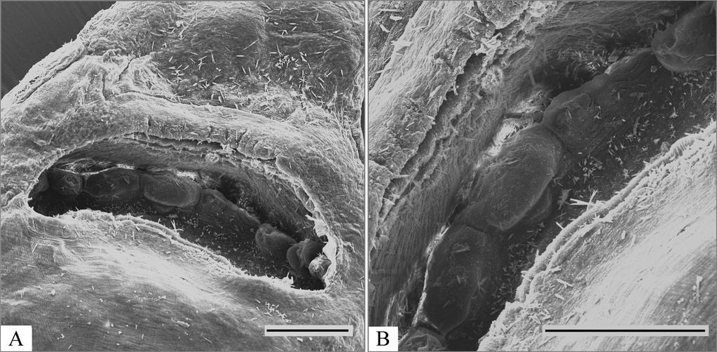 532 Sergey Sokolov et al. Fig. 2. Proctophantastes gillissi, scanning electron micrographs of ventral sucker. A general view; B fragment of horizontal ventral ridge. Scale bars: A, B 0.2 mm tubular.