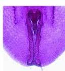 Aleyrodinae 16 Vasiform orifice acutely
