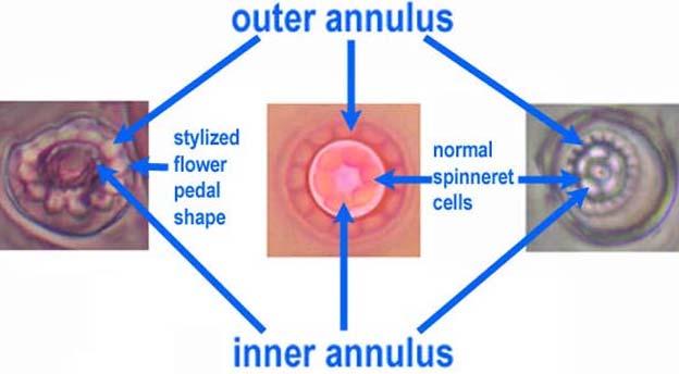 Glossary Annulus (plural, annuli), occuring in the Genus Paraleyrodes, refers to the structure in