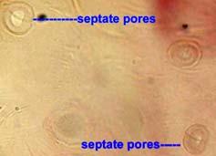 Glossary Pore-Septate pore is a circular or sub circular.
