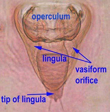 Glossary Terminal (apical) appendages of the legs consists of either an adhesion pad or a claw: The apical