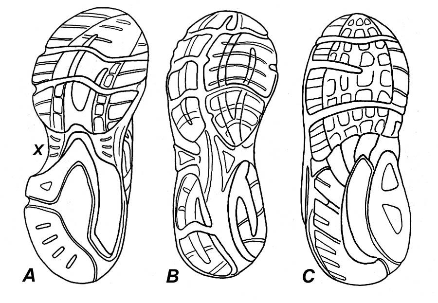 Arch Height and Running Shoes: The Best Advice to Give Patients by Thomas C.