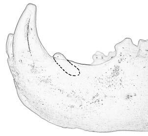 The premolar tooth is a small peg-like tooth located just behind the canines.