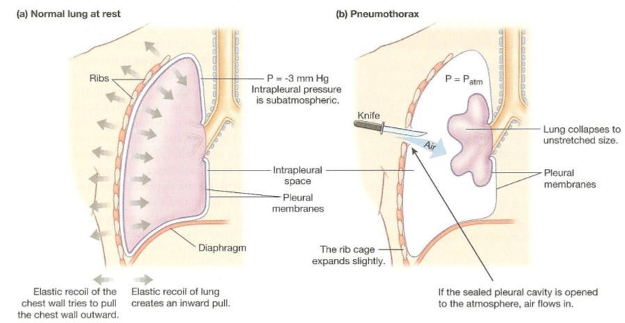 6 3. Abdominal contraction decreases abdominal volume, displacing the intestines and liver upward, decreasing the thoracic volume even more because of the organs pushing against the diaphragm