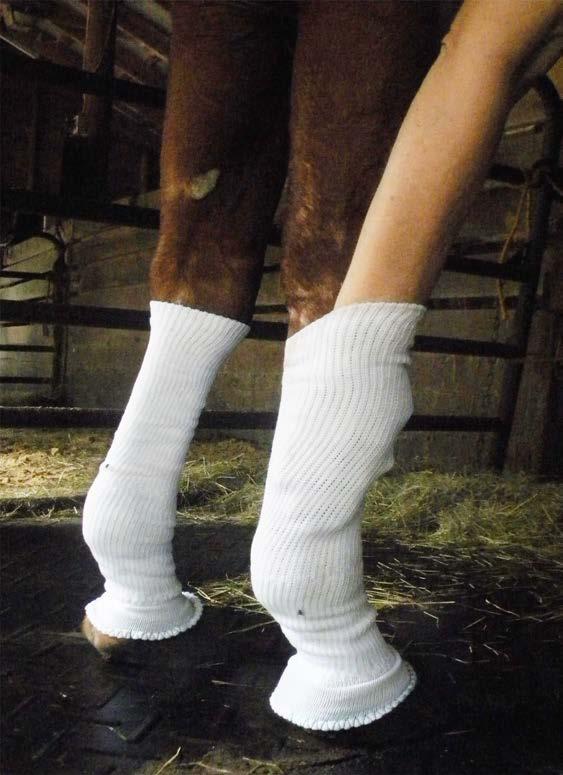 legs horses suffering from edema due to injury, chronic cellulitis, lymphedema, or lymphangitis are not normal, healthy legs!