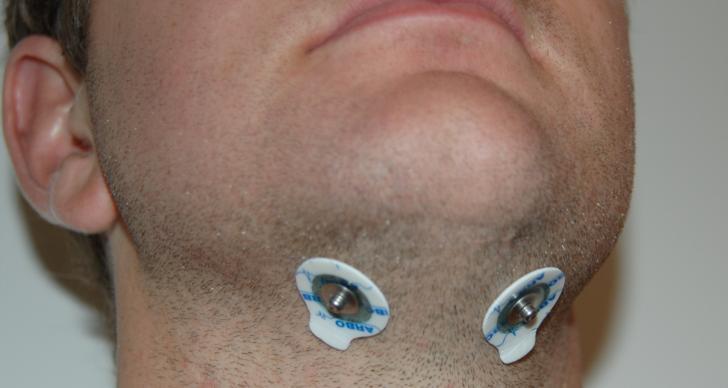 f. If you have been advised to connect chin leads, attach electrodes as shown: i. Place two electrodes underneath your chin 4-5cms apart then attach the two remaining leads to these electrodes. 5.