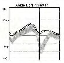 Too much plantar-flexion = spastic gastroc/soleus, tight GS/Achilles, weak tibialis anterior Too much dorsi-flexion = weak