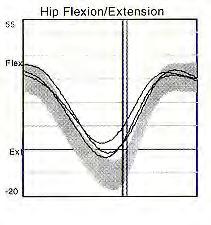 spasticity of hip flexors, pain or hip