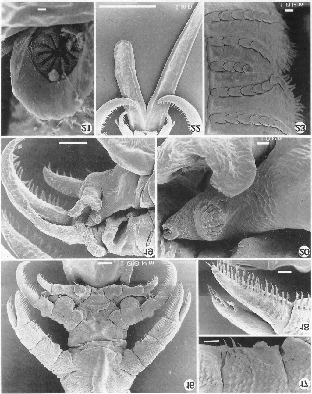 Figs. 16-23. Scanning electron micrographs of Chonopeltis liversedgei sp. n. Figs. 16-21. Male. Figs. 22, 23. Female. Fig. 16. Legs 2, 3 and 4, ventral view. Fig. 17. Bulbous protrusions on leg 2.