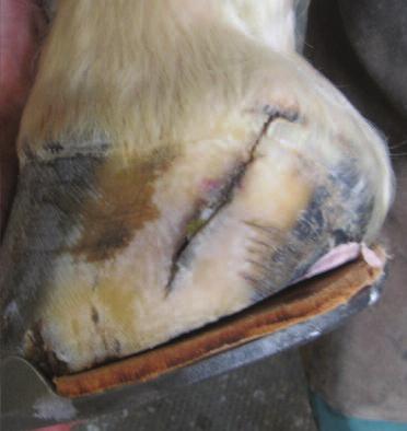 After the foot is trimmed as described above, the foot is lowered further from the quarter to the heel on the affected side before the shoe is attached.