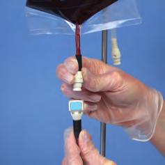 Emptying the Blood Bag and Veins 7 8 9 Connect the black sleeved tube on the