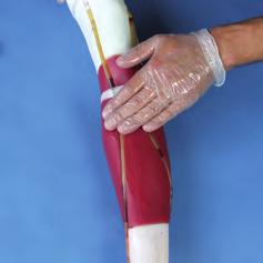 Ensure that the hand, forearm and upper