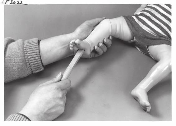 To reduce the pressure being placed on the bone, pull the plunger on the syringe back once for verification of placement.