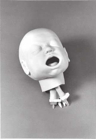 Figure 1 The Infant Airway Management Trainer Head (See figure 1.