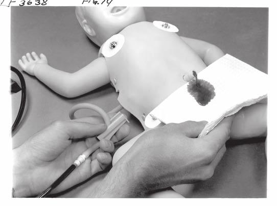 esophagus. Nasco s Infant Airway Management Trainer allows you to practice oral intubation, and suction techniques can also be performed and evaluated.