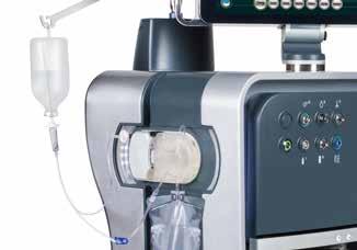 ADAPTIVE FLUIDICS dynamic surgery control Double Pump System Double Infusion System The REvolution fluidics is managed by a double pump system, based on