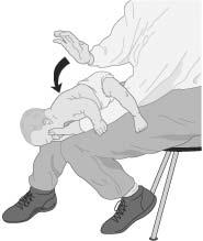 6. Do a finger sweep. Grasp the tongue and lower jaw and lift jaw. Slide the finger down inside of the cheek to base of tongue. Sweep the object out. 7. Open the airway.