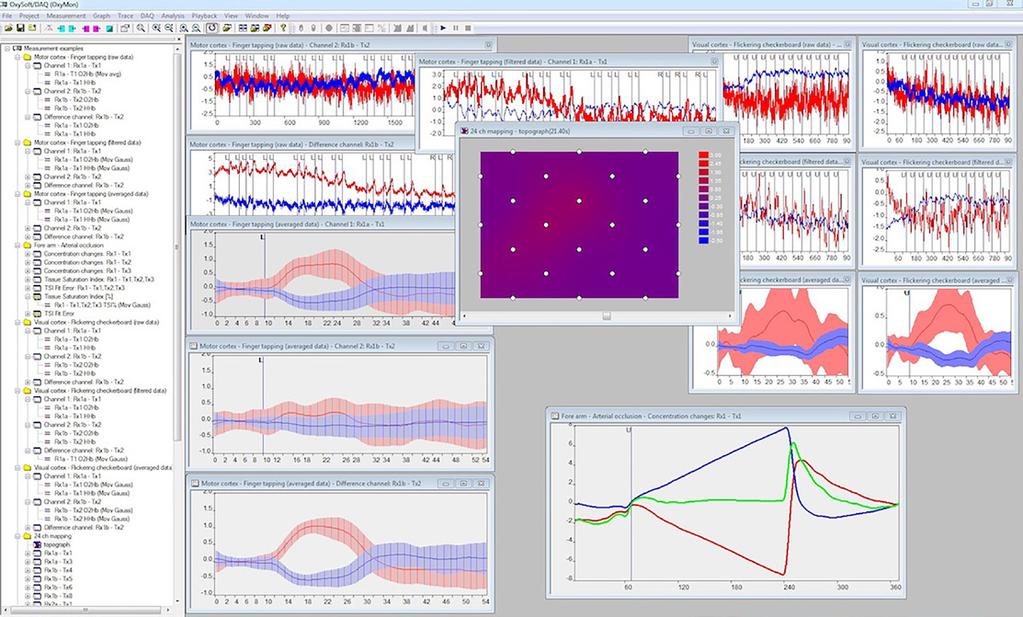 packages (SPM, Homer) + Realtime data export to Matlab + Methods for data analysis and