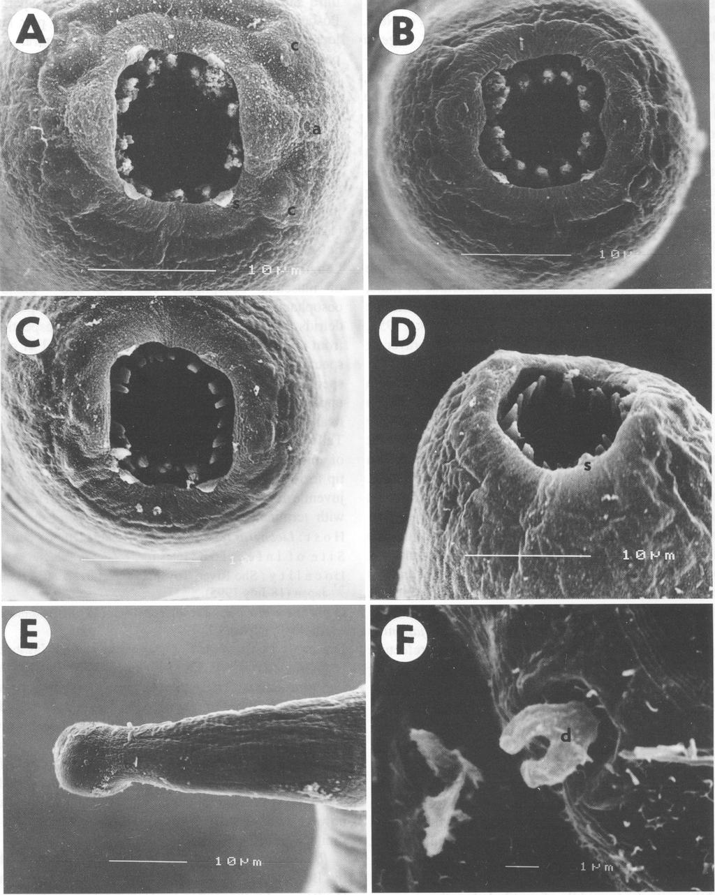 Moravec, Nagasawa: Helminths of Liobagrus Fig. 4. Rhabdochona japonica Moravec, 1975, SEM micrographs.