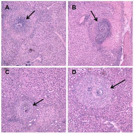 Fig 3 Hematoxylin-eosin stained livers of mice infected with praziquantel-susceptible and -resistant isolates of Schistosoma japonicum. The experimental protocol is shown in Fig 1. A.