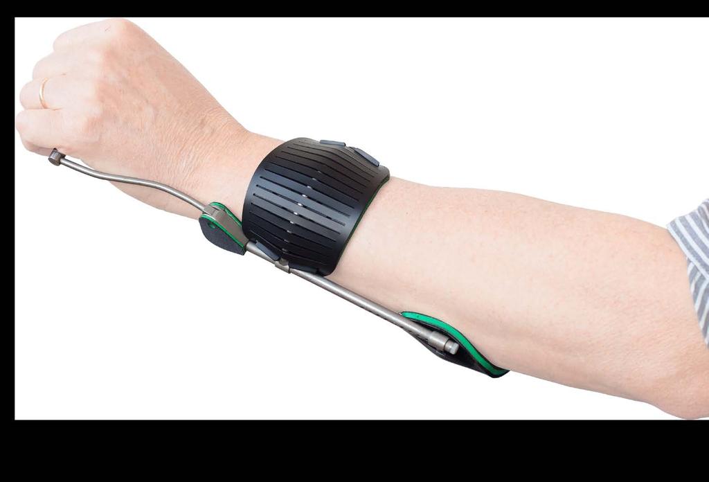 AMBROISE DYNAMIC WRIST ORTHOSIS PRODUCT INFORMATION ADPO VERSIONS The ADPO is available in one size, which can be easily adapted to the arm of the user.