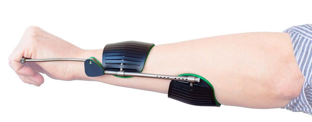 ORDER FORM SPECIAL SIZES PELOTTE CARRIERS Mail this form to info@ambroise.nl to order differently sized pelotte carriers for the wrist orthosis.