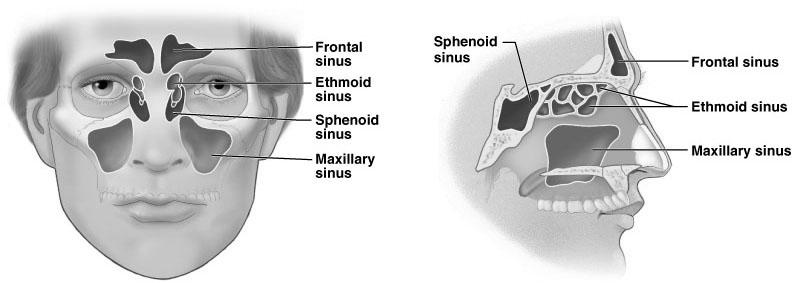 0X N S 1x Ear and Sinus Blocks Treatment of Ear/Sinus Blocks On the ascent (rare) Land and refer