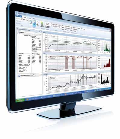 TC ResQ FAST, SIMPLE, INTUITIVE ANALY SIS Software AQURE TC ResQ is an innovative software solution that makes it fast and easy access to the data from your TCM monitor.