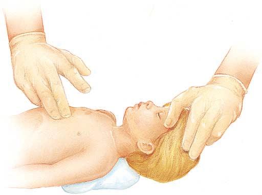 With two fingers, compress the sternum approximately one third to one half the depth of the infant s chest. Perform compressions at a rate of approximately 100/min.
